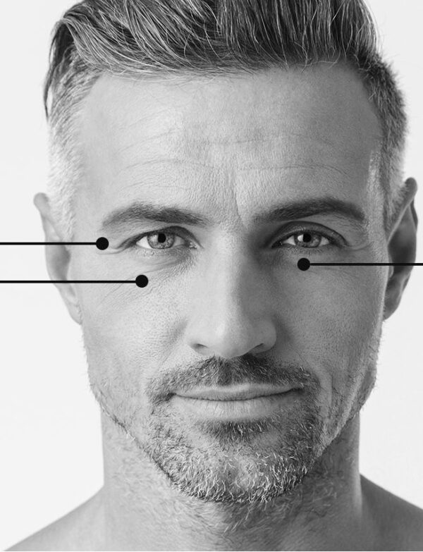 Homme • Injection • Toxine Botulique : Regard