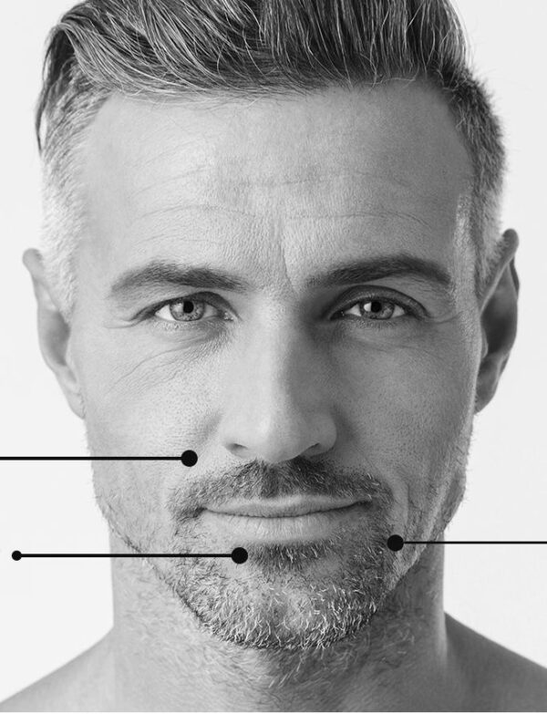 Homme • Injection • Rajeunir le visage