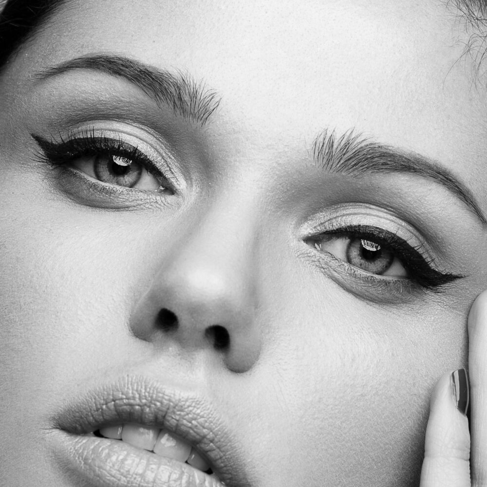 Injection • Toxine Botulique : Foxy Eyes