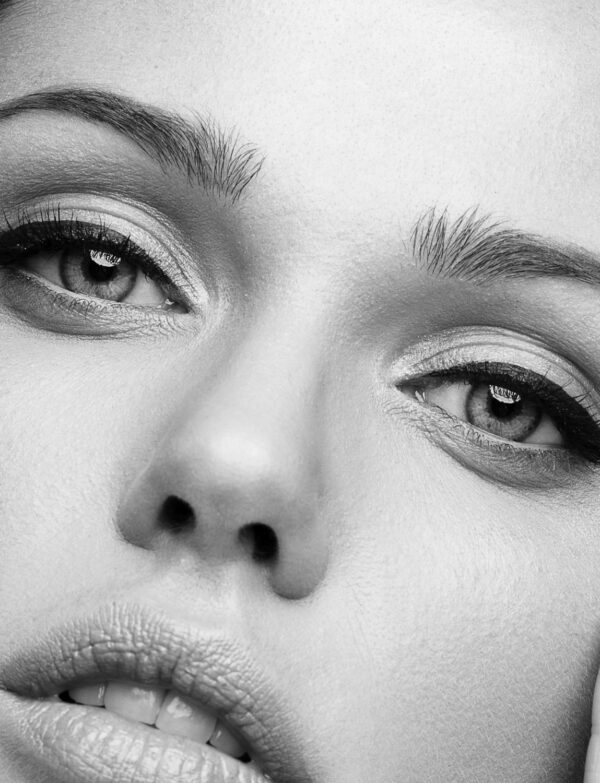 Injection • Toxine Botulique : Foxy Eyes