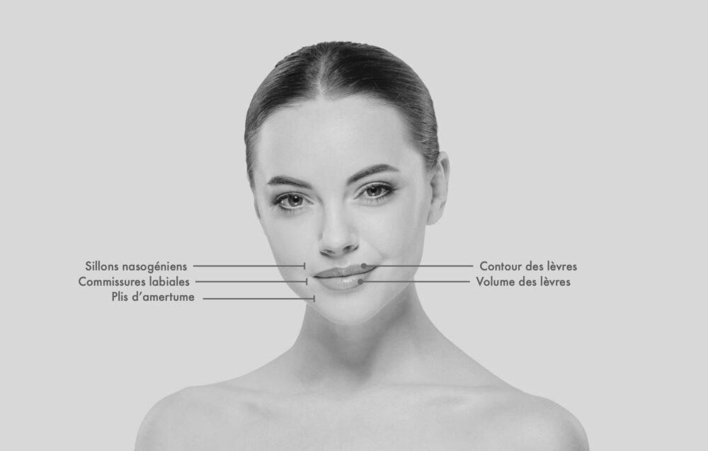 Injection • Lèvres – Image 2