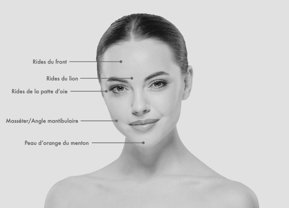 Injection • Toxine Botulique : Coup d'éclat – Image 2