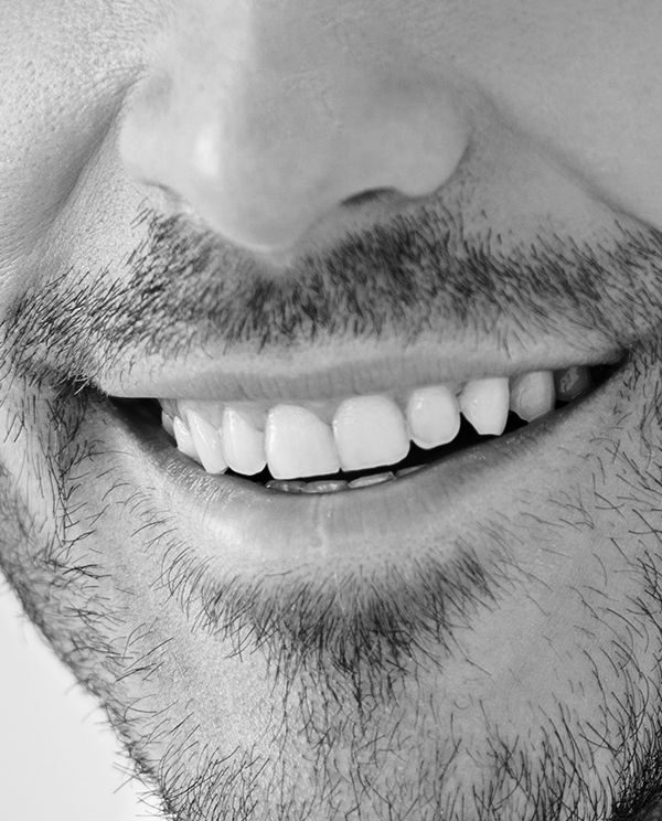 Homme • Injection • Sillons Nasogéniens