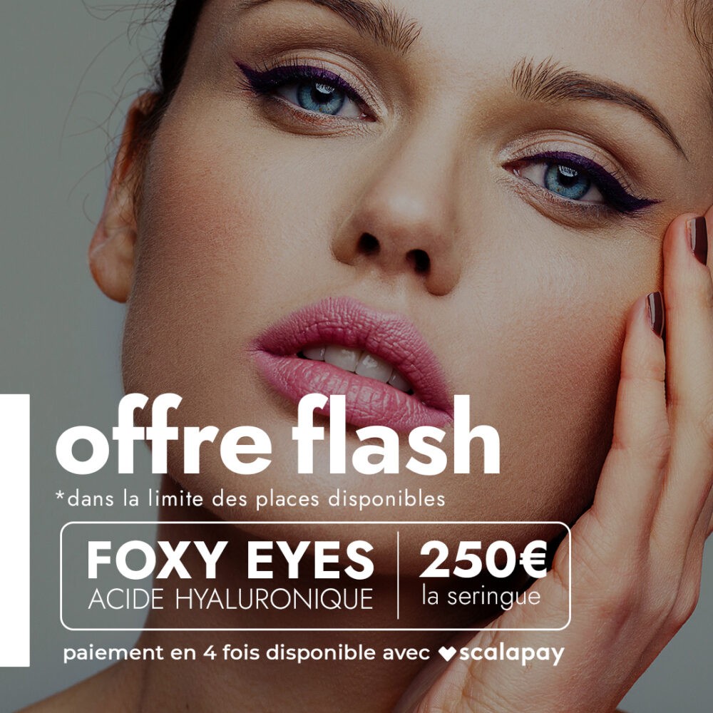 Offre FLASH - Foxy Eyes